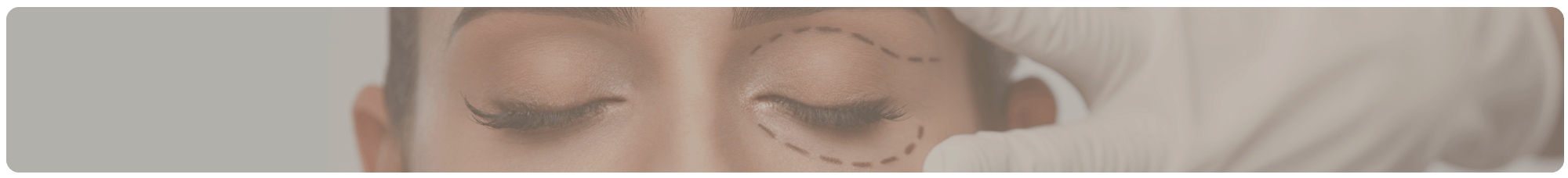 Blefaroplastia - cirurgia plástica