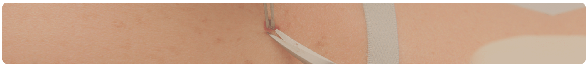 Shaving - Dermatologia Cirúrgica