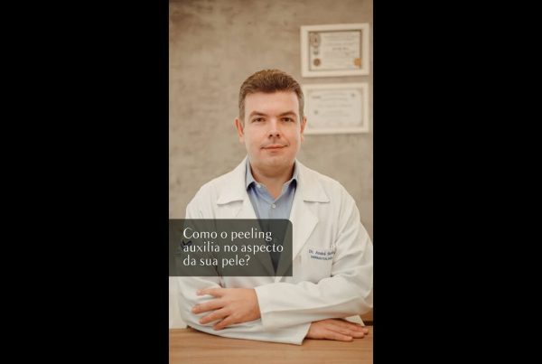 Peeling de Ácido Triclororacético